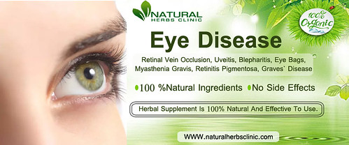 Natural Supplement for Eye Disease.
