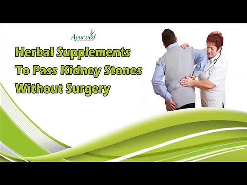 Herbal Supplements To Pass Kidney Stones Without Surgery
